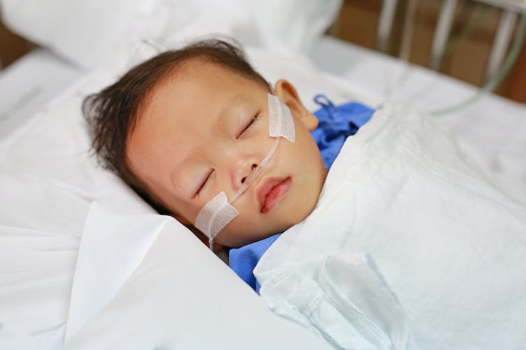 A little boy with a breathing tube sleeping in a hospital bed.