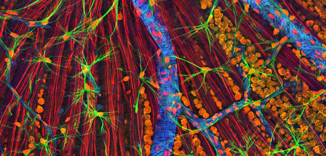 Retina neurons and cells. (Photo credit: NIGMS)